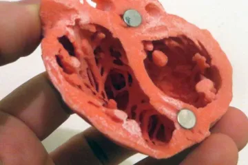 Pocovidový syndrom může vážně poškodit dětské srdce, uvádí analýza stovek případů