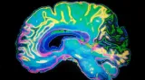 Vědec Syka: Mozek je nejsložitější organizovaná hmota ve vesmíru