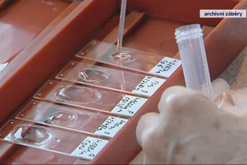 Nová léčba dává ženám s rakovinou vaječníků vyšší šance na přežití