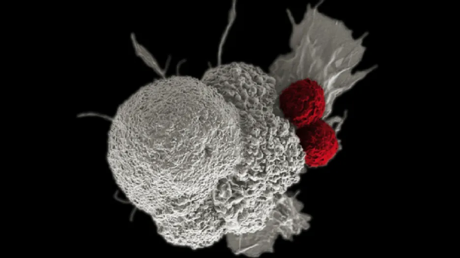 Rakovinná buňka dutiny ústní (bílá), na kterou útočí dva T-lymfocyty (červené)