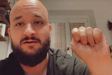 Palec ukrytý v dlani ostatními prsty. Kampaň propaguje signál pomoci