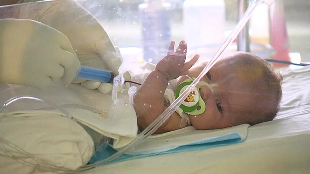 Dvouměsíční holčička podstoupila transplantaci pupečníkové krve