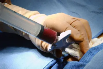 V Česku chybí dárci kostní dřeně, lékaři chtějí oslovit policisty