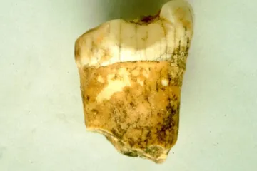 Neandertálci byli masožravci, ukázal nový výzkum. Zřejmě se ale vyhýbali krvi a kostem