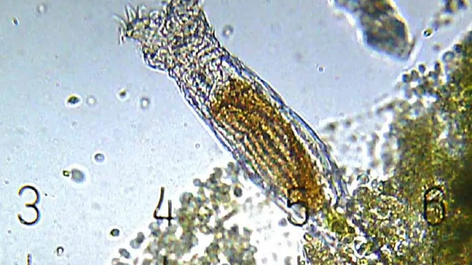 Pijavenka pod mikroskopem, ilustrační foto