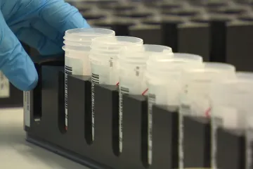 Nový test pomáhá odhalovat více případů nákazy virem HPV, který způsobuje rakovinu děložního hrdla