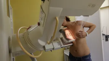 Mamografické vyšetření