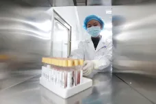 Čínská firma sbírá DNA milionů žen, testy podstoupily také Češky. Přístup k datům by údajně mohl mít Peking