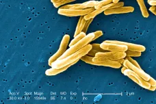 Univerzita Karlova vymyslela a prodala americké firmě vynález látek proti tuberkulóze