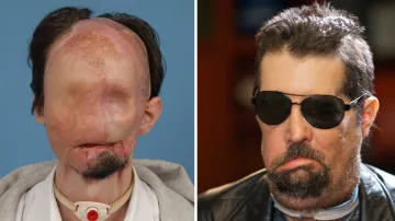 Dallas Wiens před operací a po ní