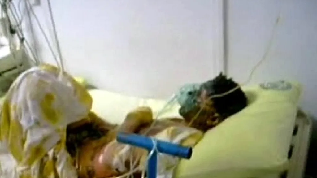 Zraněný turecký horník