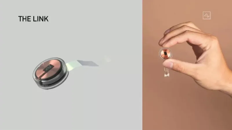 Současný vzhled implantátu Neuralinku