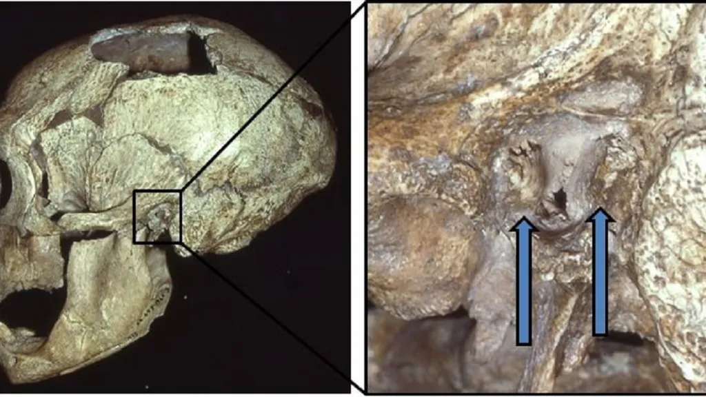 Kostní výrůstky v uších neandertálců