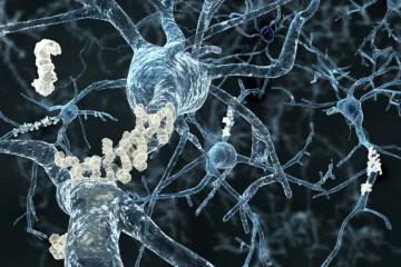 EK poprvé schválila přípravek proti Alzheimerově chorobě