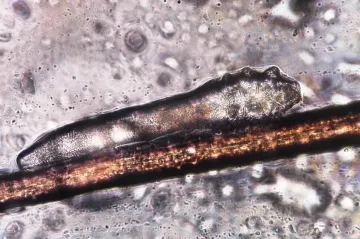 Z parazita symbiontem. Vědci popsali, jak se mění trudníci na lidských obličejích