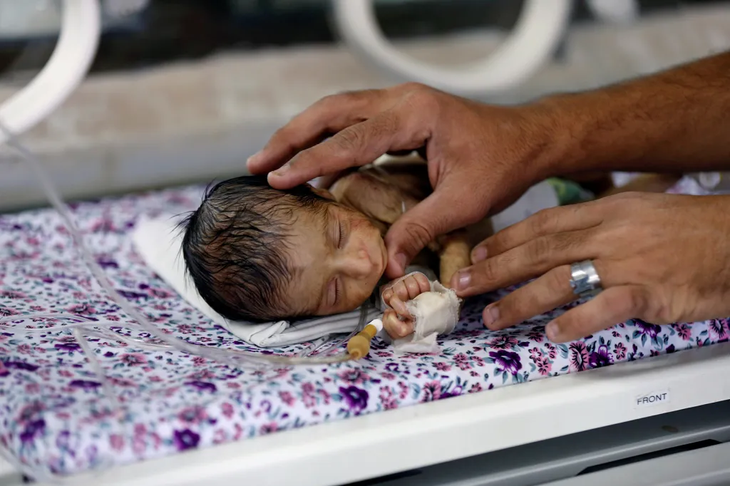 Zdravotní sestra kontroluje nedonošené dítě v inkubátoru ve středisku dětské péče v jemenské metropoli San'á