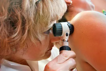 Máte znaménko s otazníkem? Zajděte do Stanu proti melanomu