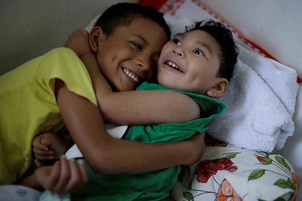 Daniel (2 roky) s vrozenou mikrocefalií se vítá se svým bratrem v jejich domě v brazilském městě Olinda. O nemoci se Danielova matka Jackeline dozvěděla během těhotenství. „Když se narodil, zamilovala jsem se do něj, přestože jsem věděla, že budeme čelit velkým problémům.“