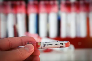 Případů žloutenky typu A je nejvíc od devadesátých let