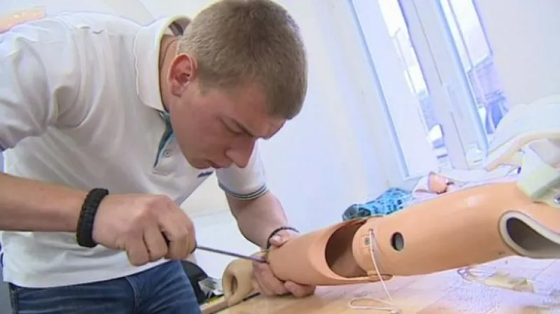 Jedenáctiletá syrská dívka má opět obě ruce