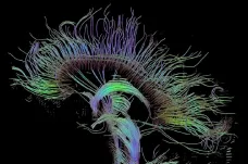 Kde se v mozku ukrývá kreativita? Neurologové ji našli mezi hemisférami