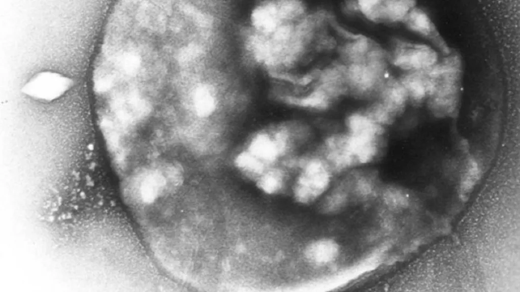 Archea druhu Sulfolobus