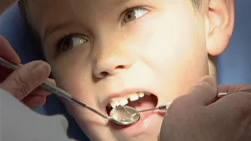 Dítě u zubaře