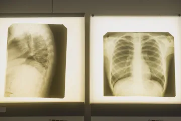 Vyřazení z výuky kvůli absenci očkování proti černému kašli nehrozí, ujistila hlavní hygienička