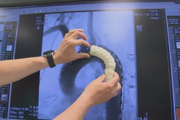 Byli mezi prvními na světě. Teď lékaři z Hradce Králové léčbu stentgraftem rozvíjejí