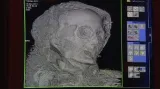 Vyšetření klatovské mumie