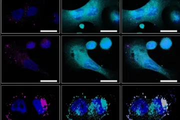 Švédský nanorobot pomocí „receptorů smrti“ cílí na rakovinové buňky