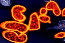 Virus nipah se přizpůsobuje lidem, jeho smrtnost ale neklesá, ukazují studie
