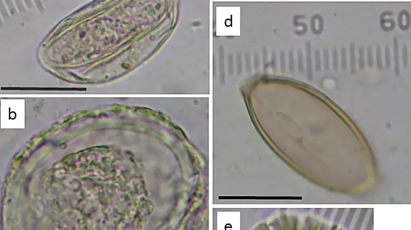 Larvy parazitů nalezené v 2700 let staré toaletě
