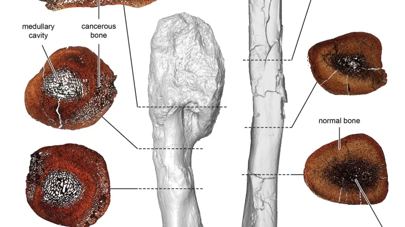 Rakovinový nádor u dinosaura