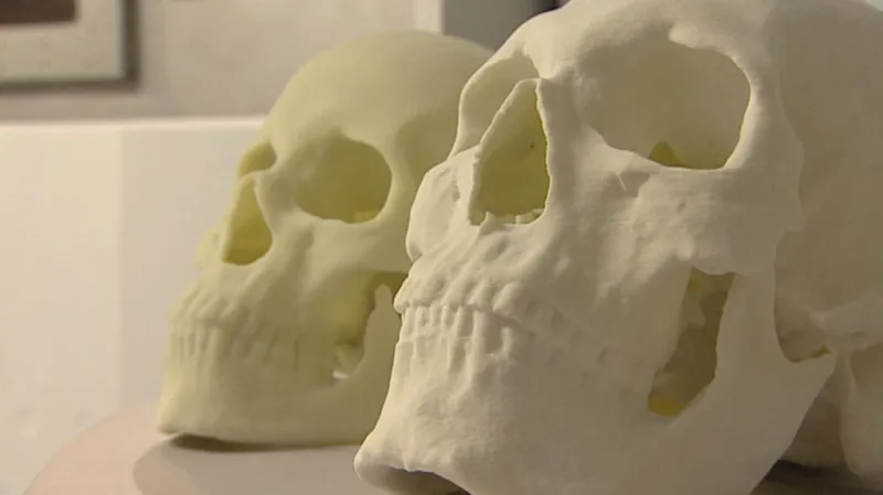 Model lebky vzniklý 3D tiskem