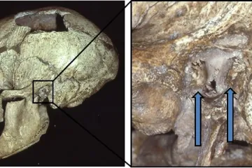 Neandertálci trpěli „surfařským uchem“. Naznačuje to, že byli chytřejší, než se myslelo