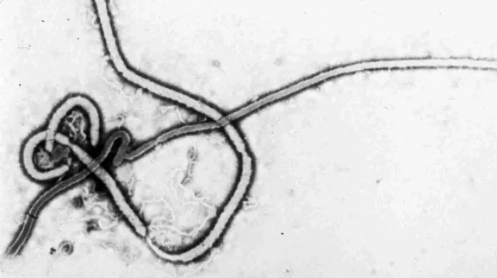 Ebola se rozšířila už i do Libérie