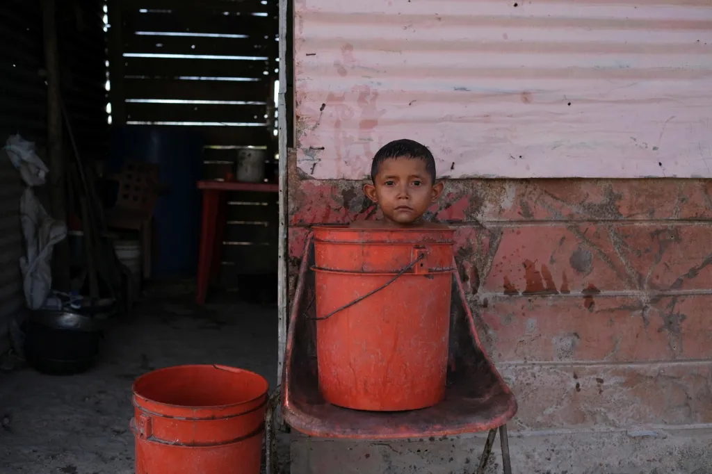 Venezuelské děti trpící podvýživou