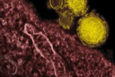 Nový koronavirus, SARS a MERS. Tři epidemie 21. století se liší smrtností, úmrtností i vlastnostmi virů