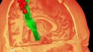 Trojrozměrný obraz mozku