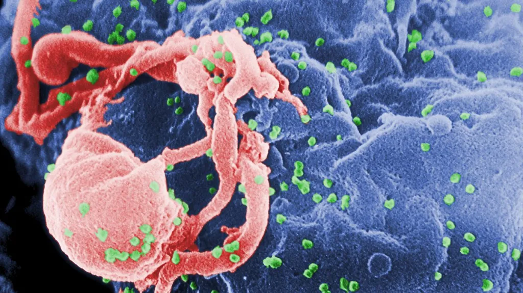 Virus HIV