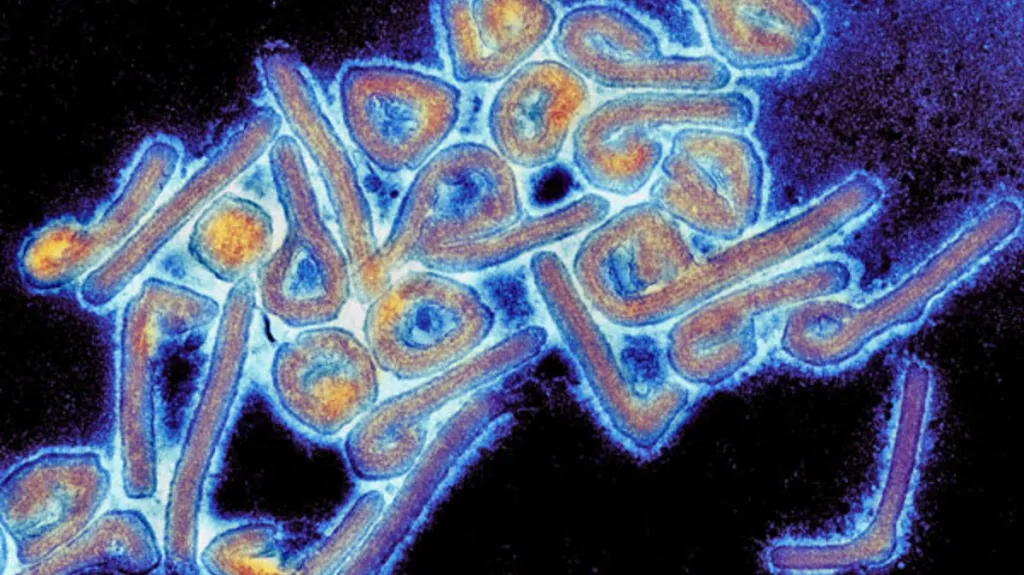 Virus marburg pod elektronovým mikroskopem, kolorováno
