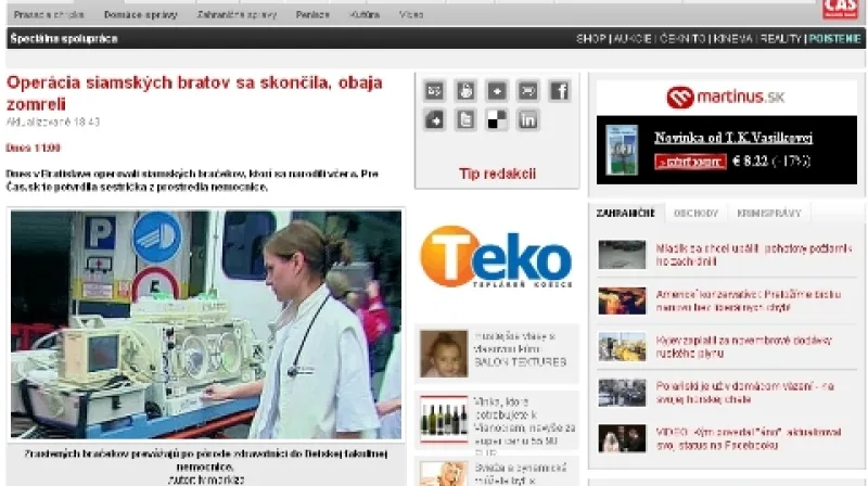 Cas.sk o operaci siamských dvojčat