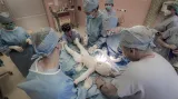 Operace 18měsíční Yulie z Ukrajiny