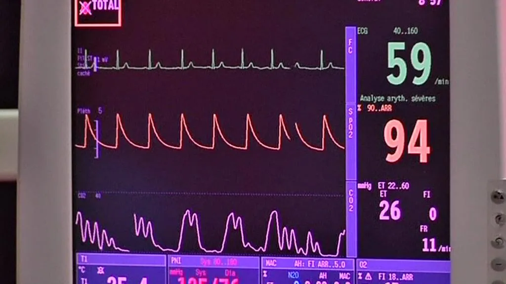 Monitor životních funkcí
