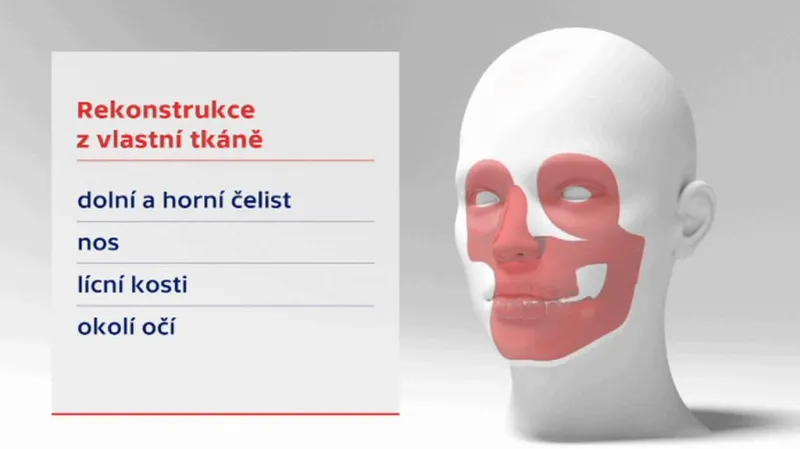 Nejčastěji prováděné operace při použití vlastní tkáně