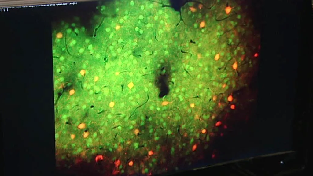 Optogenetické zobrazení mozku myši