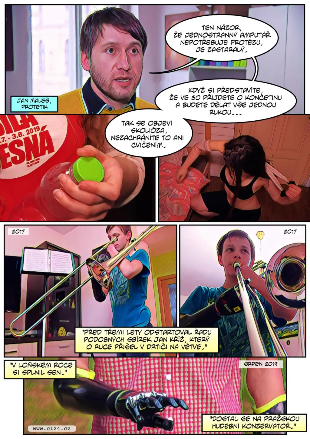 Drahé robotické protézy místo končetin. Nově mají nárok na jejich proplacení i děti s vrozenou vadou