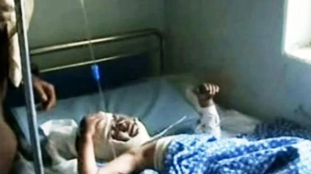 Dítě zraněné při bojích v Afghánistánu