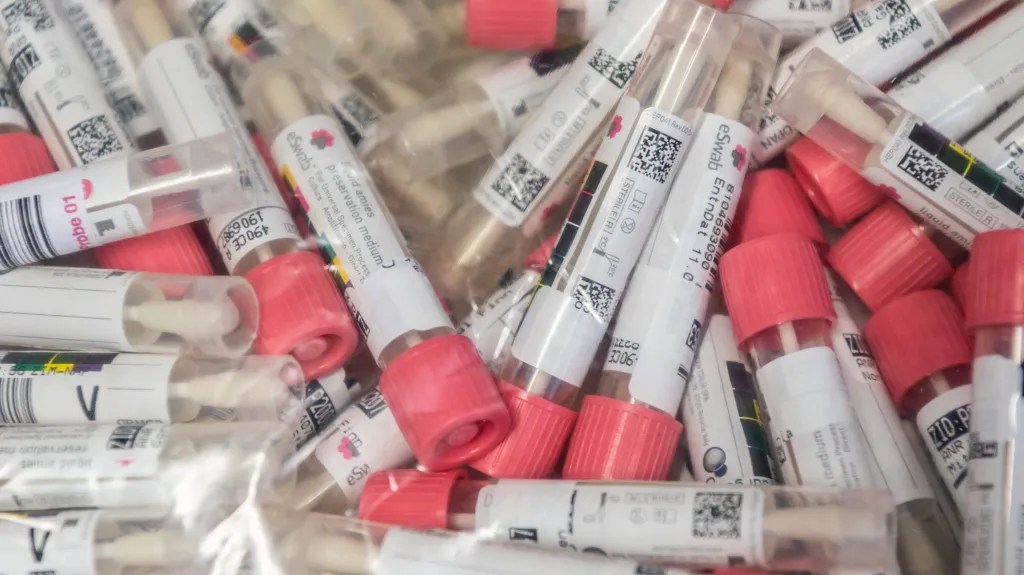 Zkumavky se vzorky pro testování na koronavirus
